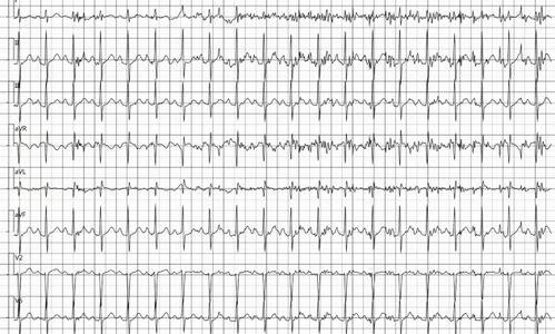 医院心电图拍照吃瓜网,揭秘医院里的“吃瓜”瞬间